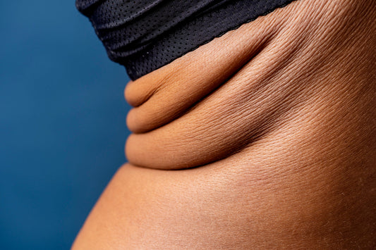 Visceral Fat  Causes, Consequences and Strategies for Reduction